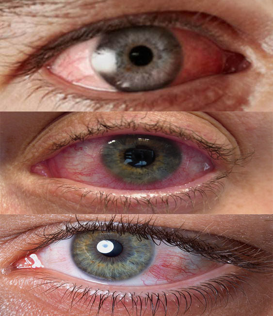 Ojos Rojos